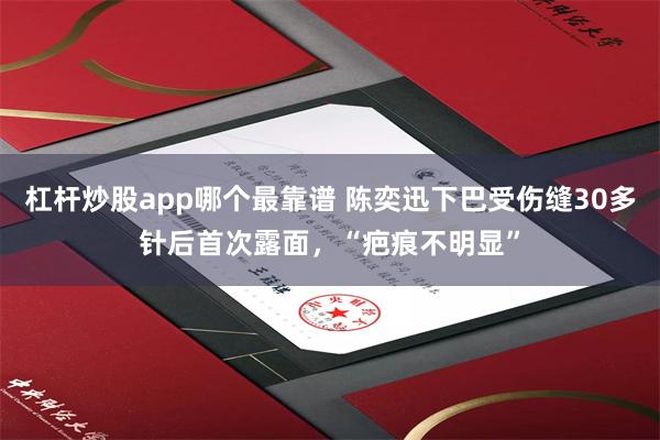 杠杆炒股app哪个最靠谱 陈奕迅下巴受伤缝30多针后首次露面，“疤痕不明显”